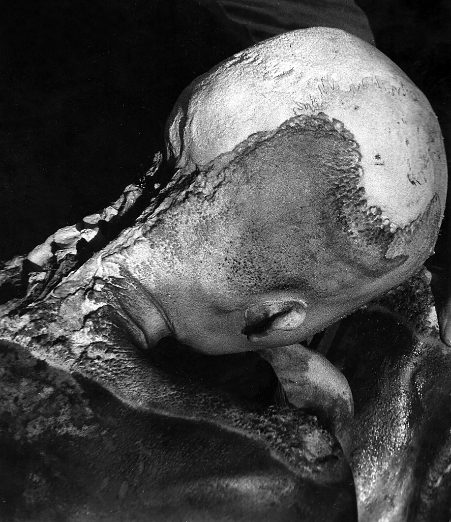 Momia de El Toro. En el cuello es visible la marca del lazo que lo estranguló. Juan Schobinger