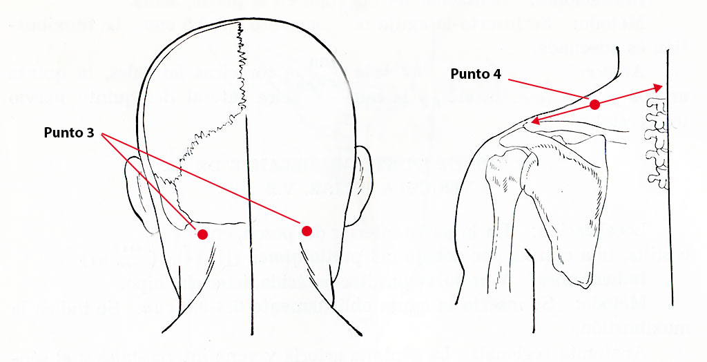Escalada Extrema en Roca y Hielo Garth Hattingh Blume (Joe Josephson en Montañas Rocosa USA)